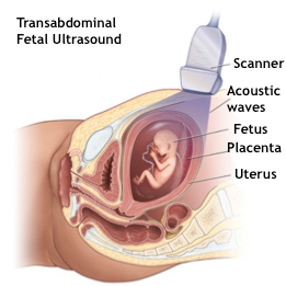 ecocardiograma fetal en